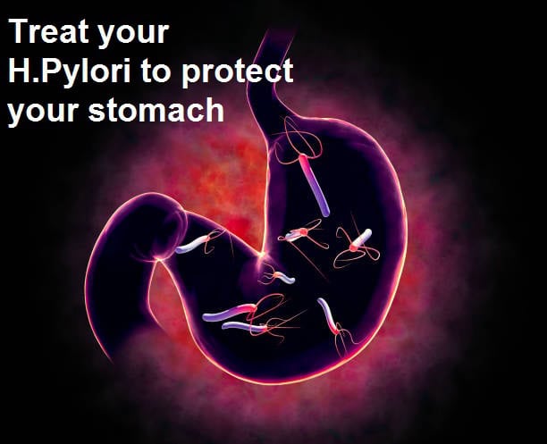 H Pylori Symptoms and Treatment
