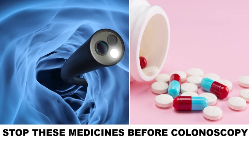 What Medications to Stop Before Colonoscopy