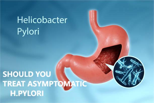 Asymptomatic H pylori: Should It Be Treated Before It Causes Damage?