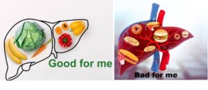 How to Lower SGPT Level