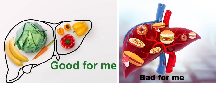 Liver Cirrhosis Foods to Avoid