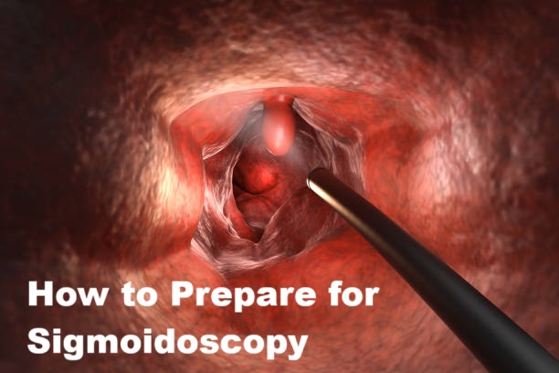 Sigmoidoscopy Preparation