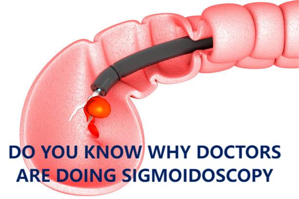 Flexible Sigmoidoscopy Indications: Top 10 Every Patient Should Know