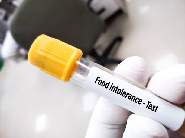 foods to avoid in lactose intolerance