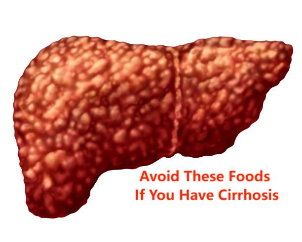 Liver Cirrhosis Foods to Avoid: 10 Dangerous Choices That Worsen Your Condition