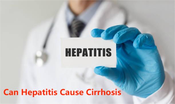 Can Hepatitis Cause Cirrhosis? The Alarming Risk You Shouldn’t Ignore