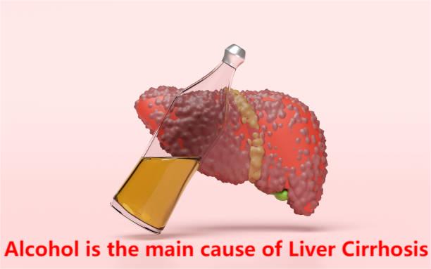 Can Alcohol Cause Cirrhosis? The Dangerous Link Doctors Want You to Know