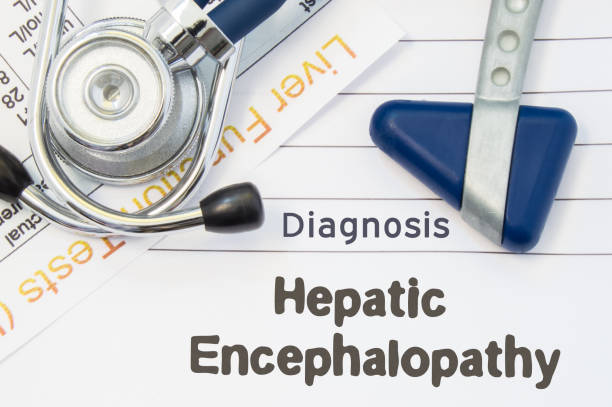 Hepatic Encephalopathy Caused by Cirrhosis: Hopeful Advances in Treatment and Recovery