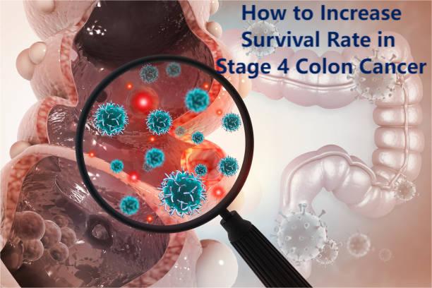 Stage 4 Colon Cancer Survival Rate: What Gives Patients the Best Chance to Live Longer