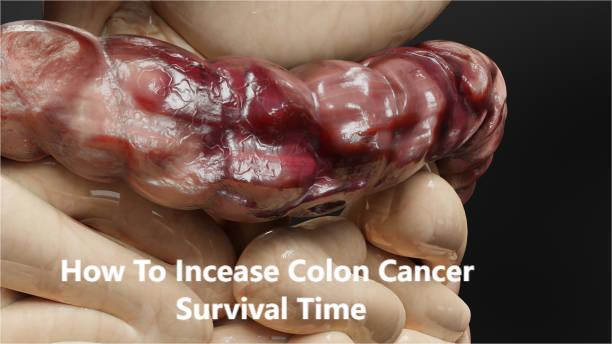 Stage 3 Colon Cancer Survival Rate: Why Recovery Is More Possible Than You Think