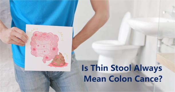 Thin stool colon cancer myth: 9 Myths and Real Colon Cancer Symptoms